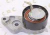 AUTOKIT 03.80392 Tensioner Pulley, timing belt